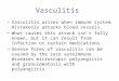 Vasculitis Vasculitis arises when immune system mistakenly attacks blood vessels. What causes this attack isn't fully known, but it can result from infection