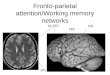 Fronto-parietal attention/Working memory networks IPS DLPFC IPS FEF