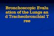 Bronchoscopic Evaluation of the Lungs and Tracheobronchial Tree