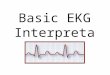 Basic EKG Interpretation. What is an EKG? Also called an ECG, it is an electrocardiogram Recording of the heart's electrical activity A series of "waves"