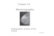 Mammography Chapter 23 2/21/2012 Radiographic studies of the breast