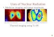 Medicine imaging and tumor treatments Thyroid imaging using Tc-99 Uses of Nuclear Radiation