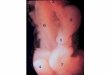 DIGESTIVE SYSTEM 01 51/2 WEEK EMBRYO: Identify the ESOPHAGUS (3), STOMACH (9), HEPATIC DIVERTICULUM (8), MIDGUT (7), and MESONEPHROS (6) on this dissected