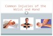 Common Injuries of the Wrist and Hand. Wrist and Hand Anatomy The hand including the wrist consists of 27 bones 8 carpals make up the wrist 5 metacarpals