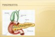 Pathophys- insult leads to leakage of pancreatic enzymes into pancreatic and peripancreatic tissue leading to acute inflammatory reaction