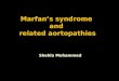 Marfan’s syndrome and related aortopathies Shehla Mohammed