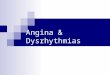 Angina & Dysrhythmias. A & P OF THE CARDIAC SYSTEM Cardiac output  CO=SV(stroke volume) X HR(heart rate) Preload  Volume of blood in the ventricles