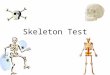 Skeleton Test 1 Which part of the vertebral column receives the most stress by bearing most of the weight of the body? –A: sacrum –B: lumbar region –C: