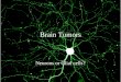 Brain Tumors Neurons or Glial cells?. Neurons Rarely, if ever responsible for tumors –Don’t reproduce