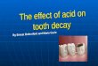 The effect of acid on tooth decay By Ernest Rutherford and Marie Curie