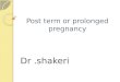 Post term or prolonged pregnancy Dr.shakeri. Definition  42completed weeks or more from the first day of LMP  When last menses was followed by ovulation