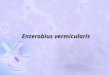 Enterobius vermicularis. Taxonomical position Phylum : Nematoda Class : Secernentea Order : Oxyurida Super family : Oxyuroidea Family : Oxyuridae Genus