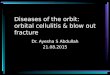 Diseases of the orbit: orbital cellulitis & blow out fracture Dr. Ayesha S Abdullah 21.08.2015