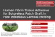 Human Fibrin Tissue Adhesive for Sutureless Patch Graft in Post-Infectious Corneal Melting Financial Disclosure: None R. P. Centre for Ophthalmic Sciences,