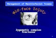 1 Zygomatic complex fractures Management of Maxillofacial Trauma