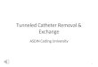 Tunneled Catheter Removal & Exchange ASDIN Coding University 1