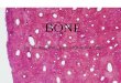 BONE The most amazing story of bone histology!. Functions of Bone Supports soft tissue Protects vital organs (cranium, thoracic cavity) Contains bone