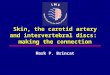 Skin, the carotid artery and intervertebral discs: making the connection Mark P. Brincat