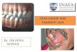 Oral cancer and Inpatient care By :DR.HINA ADNAN