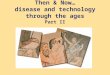Then & Now… disease and technology through the ages Part II