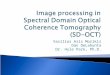 Image processing in Spectral Domain Optical Coherence Tomography (SD-OCT)