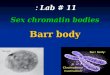 Lab # 11 :  Sex  chromatin bodies Barr body