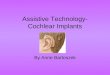 Assistive Technology- Cochlear Implants