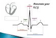 Annotate your ECG