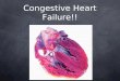 Congestive Heart Failure!!