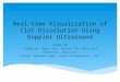 Real-time Visualization of Clot Dissolution Using Doppler Ultrasound