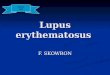 Lupus  erythematosus