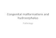 Congenital malformations and hydrocephalus