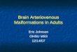 Brain Arteriovenous Malformations in Adults