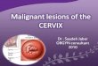 Malignant lesions of the CERVIX