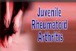 Normal knee anatomy Symptoms and pathology of juvenile rheumatoid arthritis Pain management