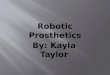Robotic Prosthetics