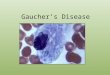 Gaucher’s Disease