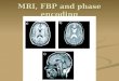 MRI, FBP and phase encoding