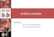 Orbital  cellulitis