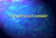 THE DIFFICULT AIRWAY