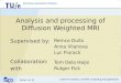 Analysis  and processing of  Diffusion Weighted  MRI