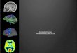 Neuroimaging Processing : Overview ,  Limitations ,  pitfalls, etc . etc