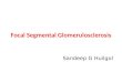 Focal Segmental  Glomerulosclerosis