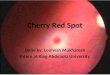 Cherry Red Spot