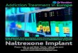 Naltrexone implant treatment in Europe