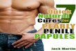 7 Quick Natural Cures for Pearly Penile Papules