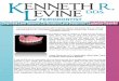 Snug Today, Loose Tomorrow: The Mystery of Loose Dentures in Ft. Lauderdale Unraveled