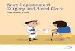 Knee Replacement Surgery and Blood Clots