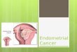 CA Endometrium
