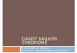 Dandy Walker Syndrome
